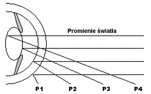 Rodzaje obrazów Purkinjego